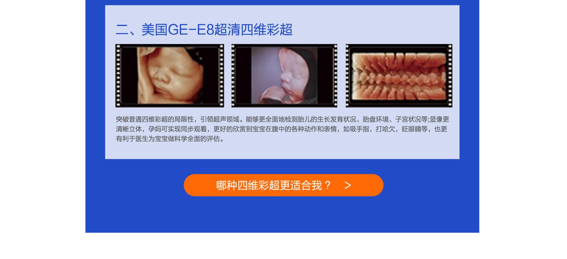 二、美国GE-E8超清四维彩超 突破普通四维彩超的局限性，引领超声领域。能够更全面地检测胎儿的生长发育状况、胎盘环境、子宫状况等;显像更清晰立体，孕妈可实现同